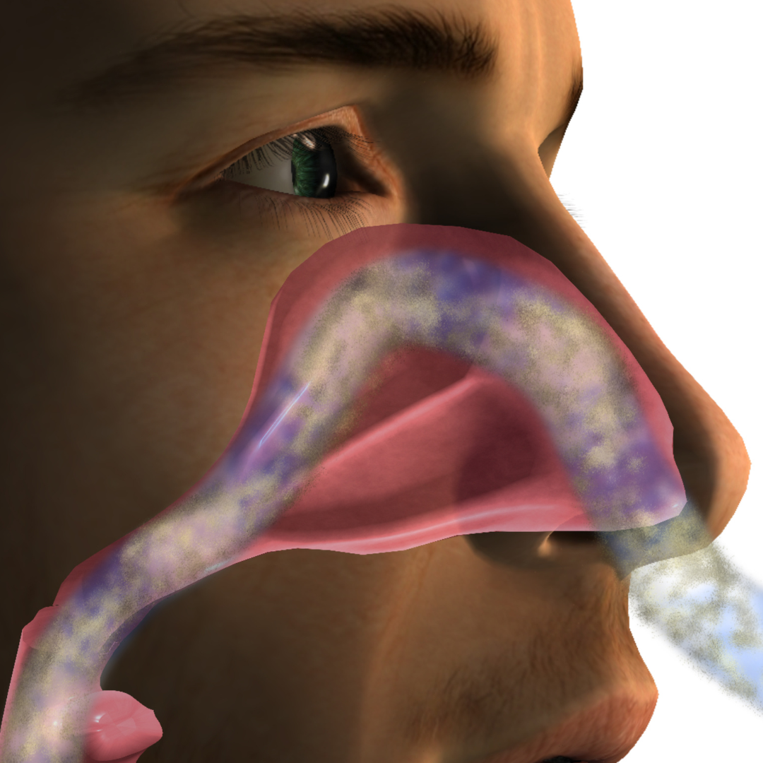 Lavagem nasal capa